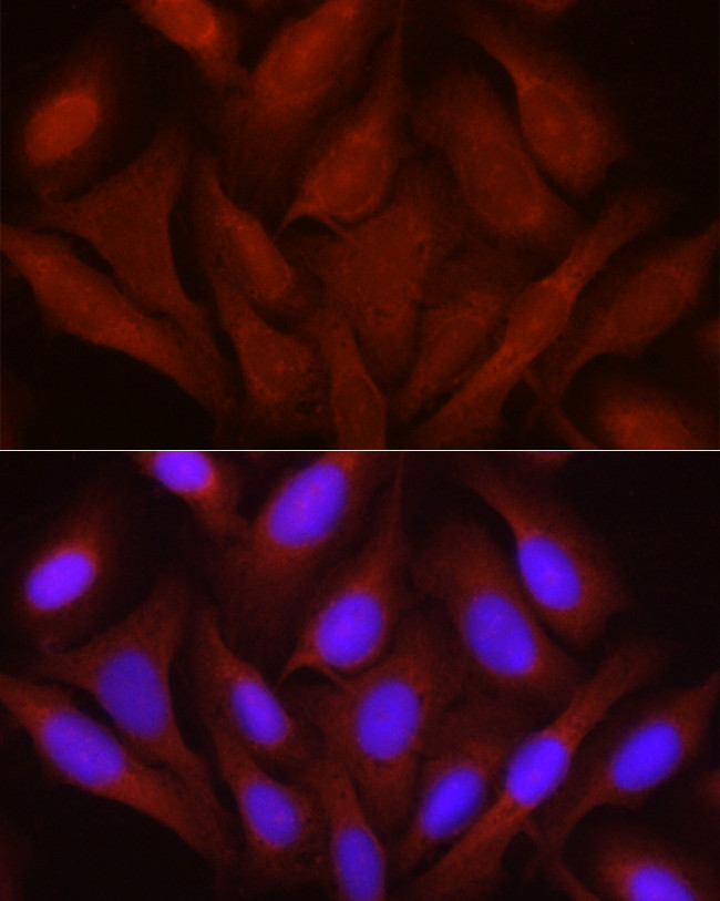 JNK1/JNK2/JNK3 Antibody in Immunocytochemistry (ICC/IF)