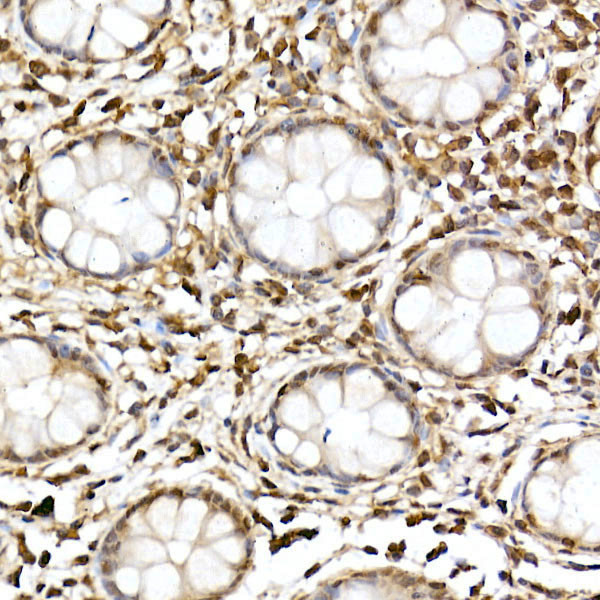 JNK1/JNK2/JNK3 Antibody in Immunohistochemistry (Paraffin) (IHC (P))