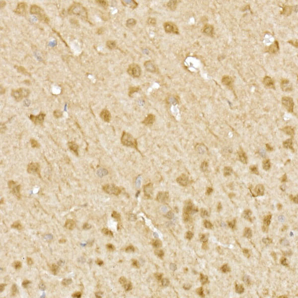 JNK1/JNK2/JNK3 Antibody in Immunohistochemistry (Paraffin) (IHC (P))