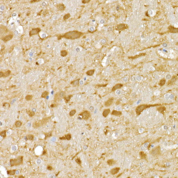 JNK1/JNK2/JNK3 Antibody in Immunohistochemistry (Paraffin) (IHC (P))