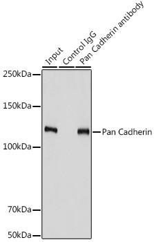 Pan-cadherin Antibody in Immunoprecipitation (IP)
