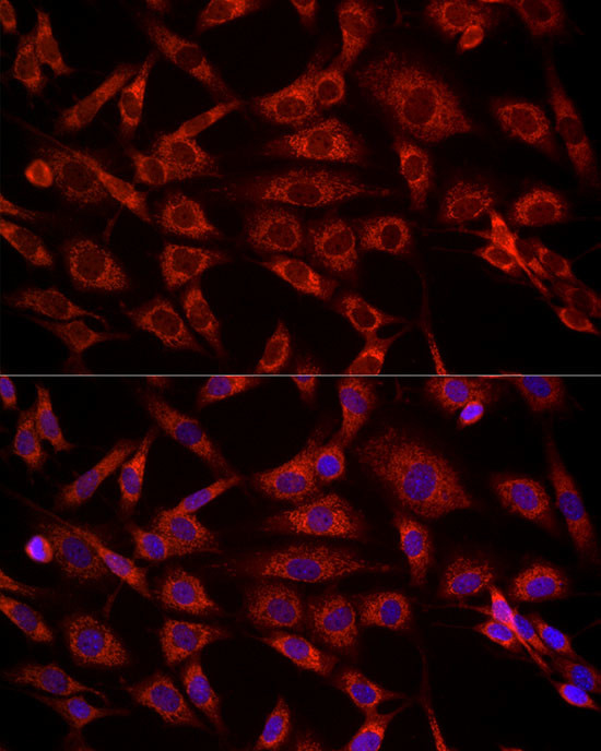 VDAC2 Antibody in Immunocytochemistry (ICC/IF)