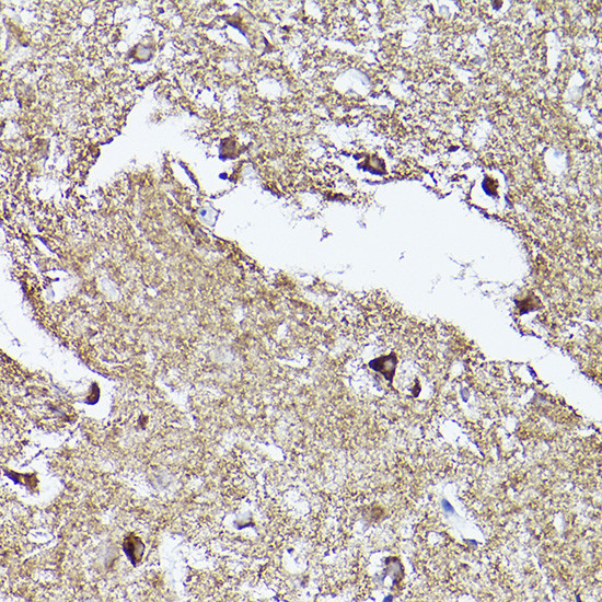 VDAC2 Antibody in Immunohistochemistry (Paraffin) (IHC (P))