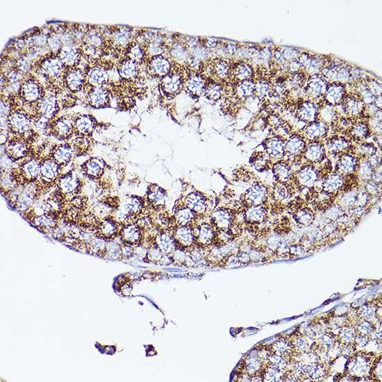 VDAC2 Antibody in Immunohistochemistry (Paraffin) (IHC (P))