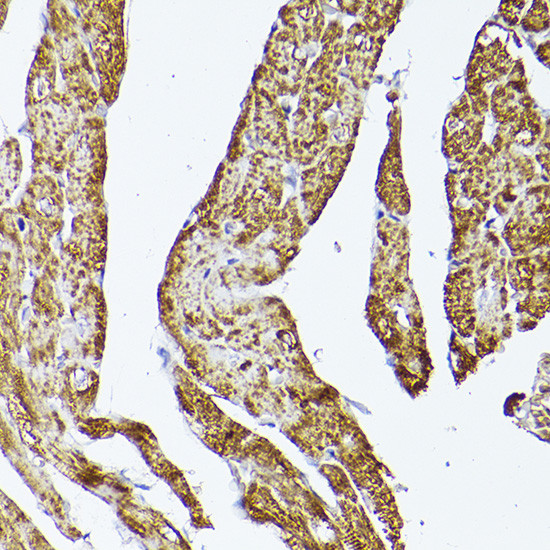 VDAC2 Antibody in Immunohistochemistry (Paraffin) (IHC (P))