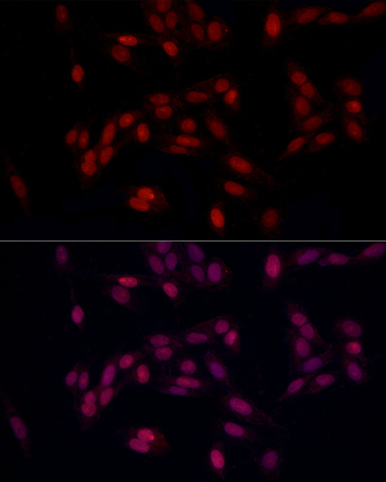 SUPT16H Antibody in Immunocytochemistry (ICC/IF)