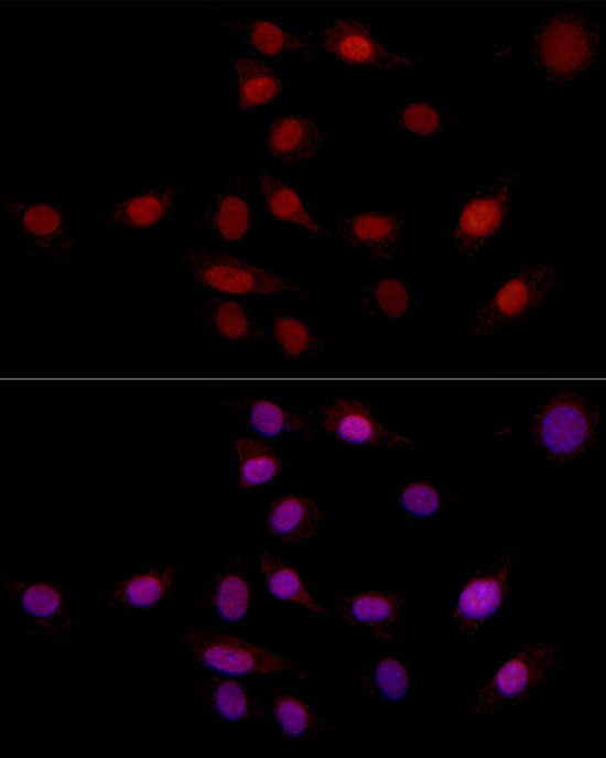 SUPT16H Antibody in Immunocytochemistry (ICC/IF)