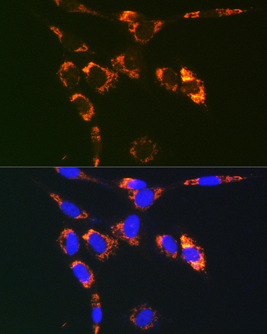 VAMP7 Antibody in Immunocytochemistry (ICC/IF)