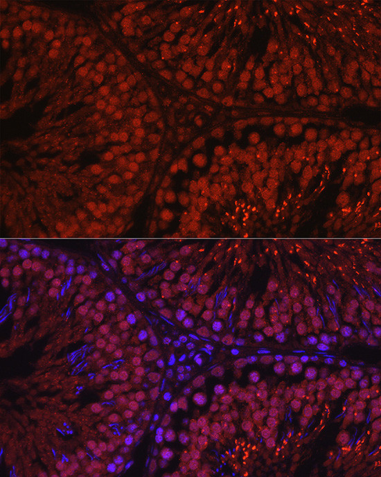 C1orf146 Antibody in Immunohistochemistry (Paraffin) (IHC (P))