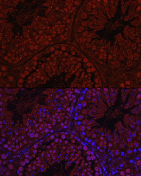 C1orf146 Antibody in Immunohistochemistry (Paraffin) (IHC (P))