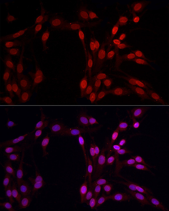 Lamin B1 Antibody in Immunocytochemistry (ICC/IF)