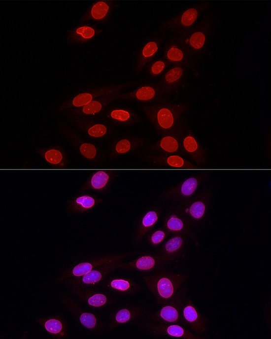 Lamin B1 Antibody in Immunocytochemistry (ICC/IF)