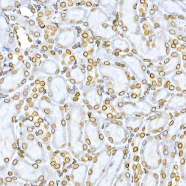 Lamin B1 Antibody in Immunohistochemistry (Paraffin) (IHC (P))