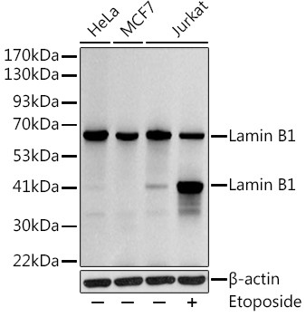 Lamin B1 Antibody in Western Blot (WB)