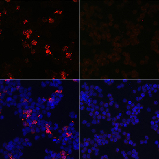 SARS-CoV-2 Spike Protein (RBD) Antibody in Immunocytochemistry (ICC/IF)