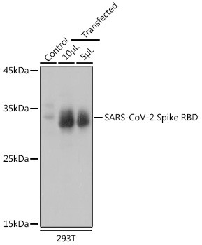 SARS-CoV-2 Spike Protein (RBD) Antibody in Western Blot (WB)