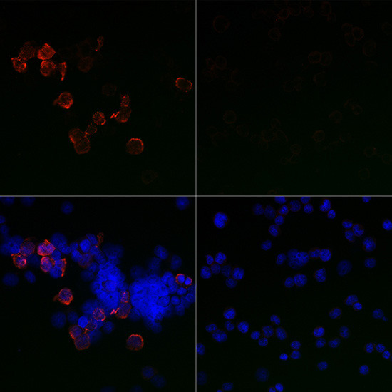 SARS-CoV-2 Spike Protein S1 Antibody in Immunocytochemistry (ICC/IF)