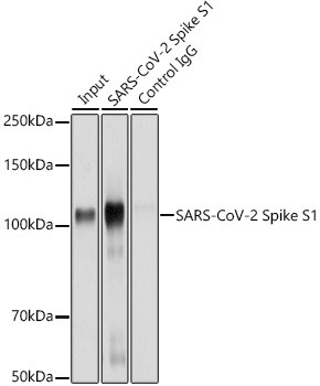 SARS-CoV-2 Spike Protein S1 Antibody in Immunoprecipitation (IP)