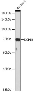 DCP1B Antibody in Western Blot (WB)