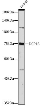 DCP1B Antibody in Western Blot (WB)