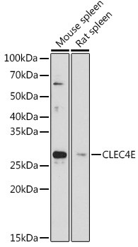 CLEC4E Antibody in Western Blot (WB)