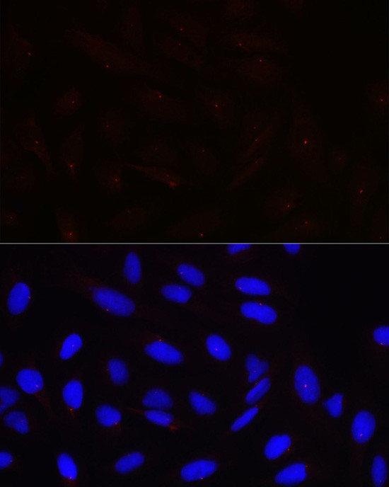 Pericentrin Antibody in Immunocytochemistry (ICC/IF)