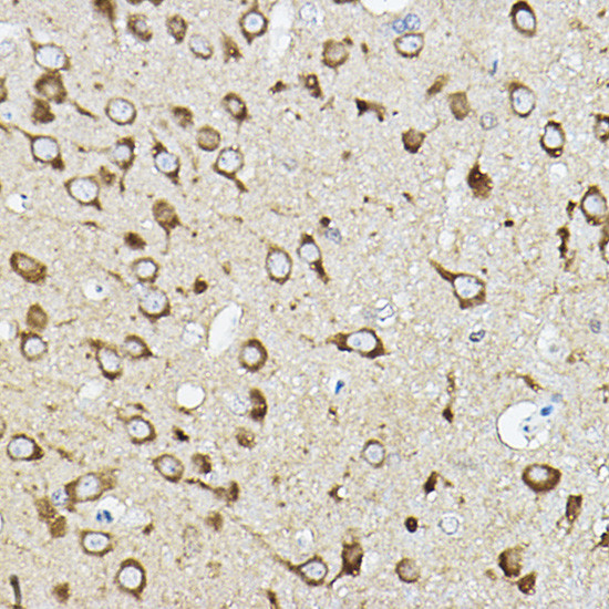 ATP6V1G2 Antibody in Immunohistochemistry (Paraffin) (IHC (P))