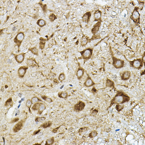 ATP6V1G2 Antibody in Immunohistochemistry (Paraffin) (IHC (P))