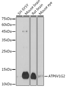 ATP6V1G2 Antibody in Western Blot (WB)