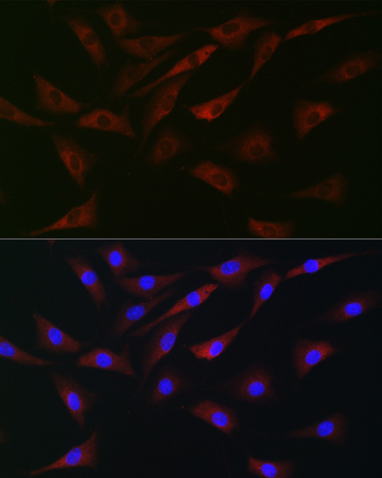 EIF4A1/EIF4A2/EIF4A3 Antibody in Immunocytochemistry (ICC/IF)