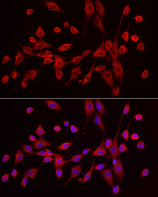 EXT1 Antibody in Immunocytochemistry (ICC/IF)