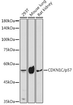 p57 Kip2 Antibody in Western Blot (WB)