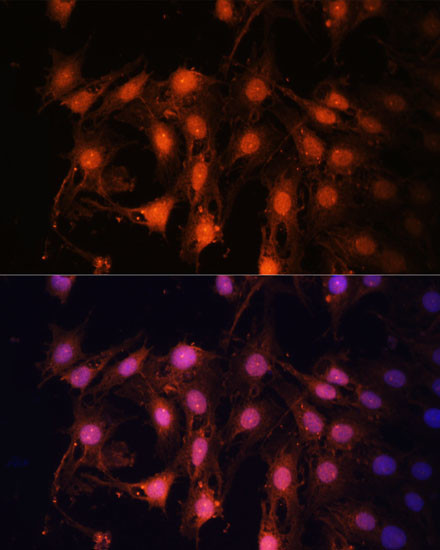 E2F1 Antibody in Immunocytochemistry (ICC/IF)