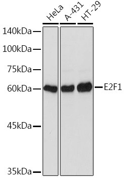 E2F1 Antibody in Western Blot (WB)