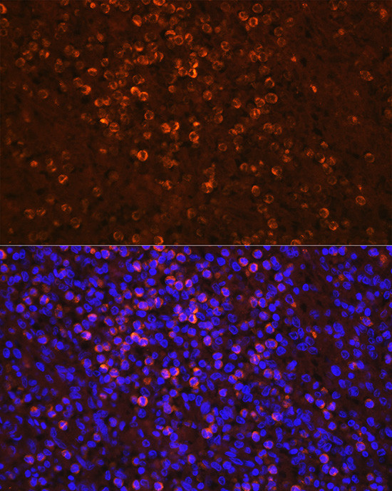 NGAL Antibody in Immunocytochemistry (ICC/IF)