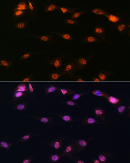 ALOX5 Antibody in Immunocytochemistry (ICC/IF)