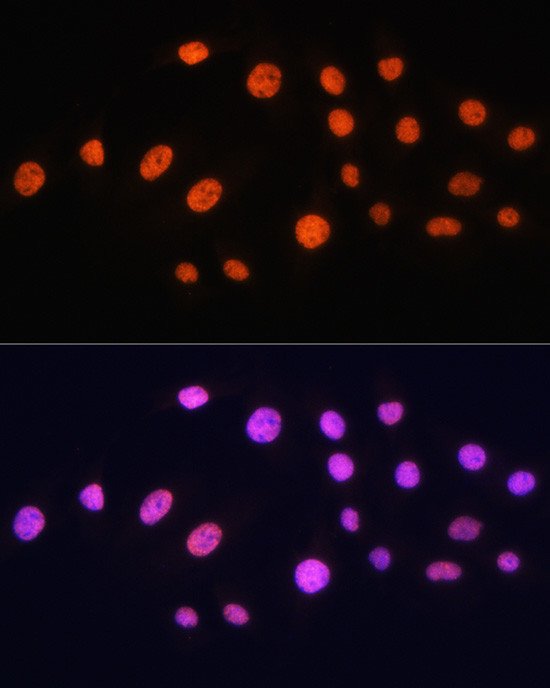 GCN5 Antibody in Immunocytochemistry (ICC/IF)