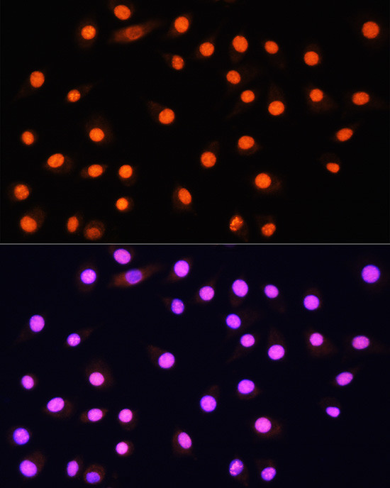 GCN5 Antibody in Immunocytochemistry (ICC/IF)