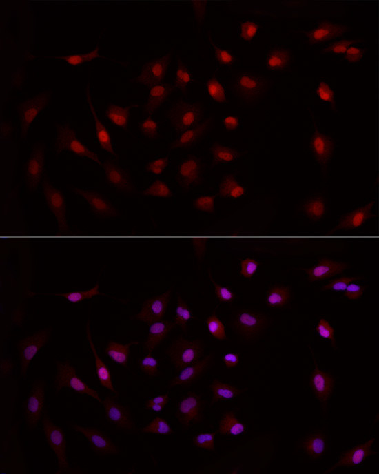 GCN5 Antibody in Immunocytochemistry (ICC/IF)