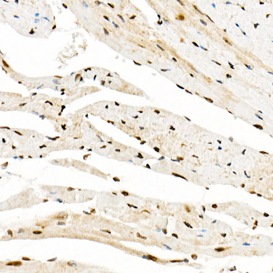 GCN5 Antibody in Immunohistochemistry (Paraffin) (IHC (P))