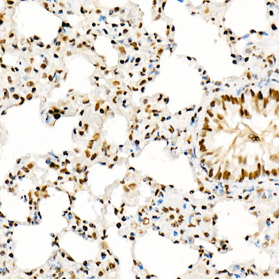 GCN5 Antibody in Immunohistochemistry (Paraffin) (IHC (P))