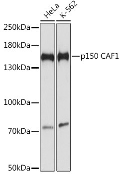 CAF1 p150 Antibody in Western Blot (WB)