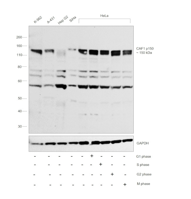 CAF1 p150 Antibody in Western Blot (WB)