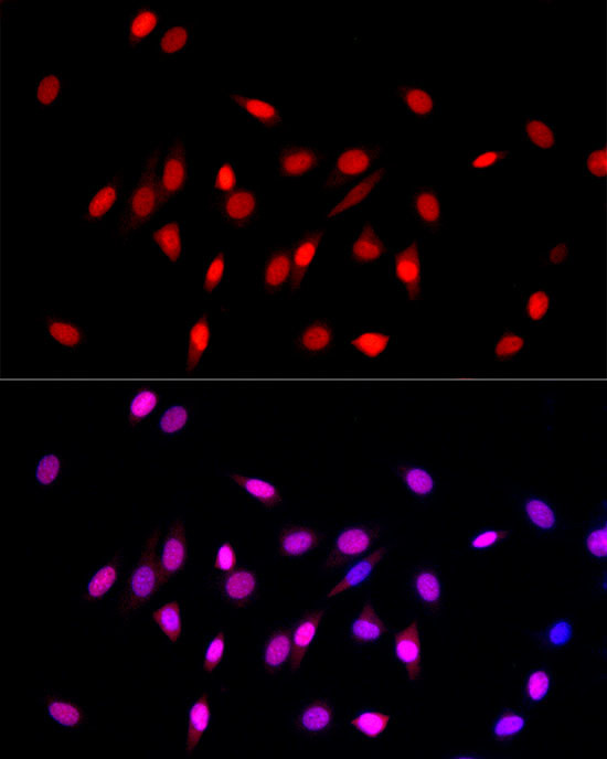 H3K27me1 Antibody in Immunocytochemistry (ICC/IF)