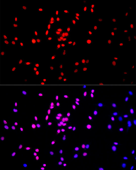 H3K27me1 Antibody in Immunocytochemistry (ICC/IF)