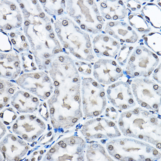 H3K27me1 Antibody in Immunohistochemistry (Paraffin) (IHC (P))