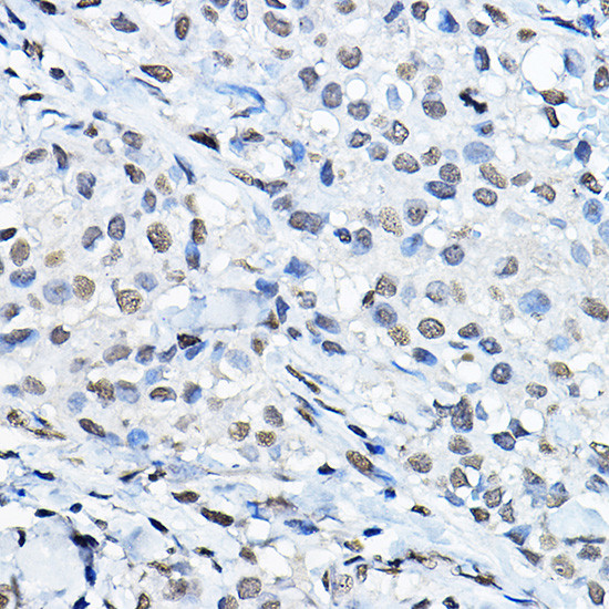 H3K27me1 Antibody in Immunohistochemistry (Paraffin) (IHC (P))