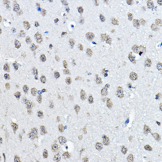 H3K27me1 Antibody in Immunohistochemistry (Paraffin) (IHC (P))