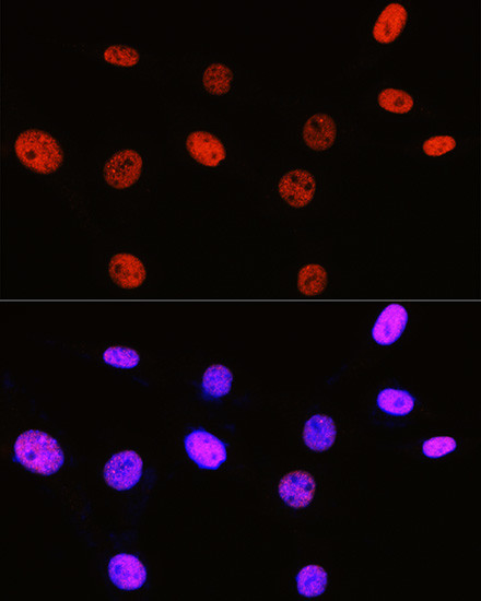 H3R2me2s Antibody in Immunocytochemistry (ICC/IF)