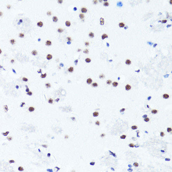 H3R2me2s Antibody in Immunohistochemistry (Paraffin) (IHC (P))